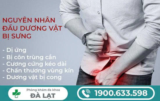 Hình ảnh minh họa